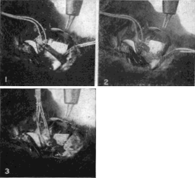 Demonstration Upon the Eye of a Rabbit that the Inferior Oblique Muscle is an Essential Factor in Accommodation