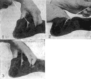 Demonstration Upon the Eye of a Rabbit That the Production of Refractive Errors Is Dependent Upon the Action of the External Muscles. The String Is Fastened to the Insertion of the Superior Oblique and Rectus Muscles