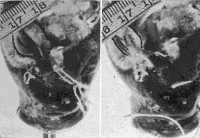 Demonstration Upon the Eye of a Carp That the Recti Shorten the Visual Axis in Hypermetropia