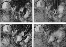 Experiment Upon the Eye of a Cat Demonstrating That the Fourth Nerve, Which Supplies Only the Superior Oblique Muscle, Is Just as Much a Nerve of Accommodation As the Third, and That the Superior Oblique Muscle Which It Supplies Is a Muscle of Accommodation